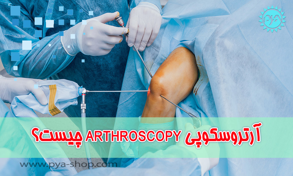 آرتروسکوپی Arthroscopy چیست؟